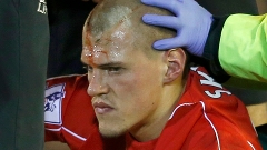 Sangue, susto e superação: Skrtel é o 'salvador' do Liverpool no empate com o Arsenal